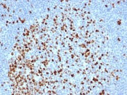 TOP2A Antibody (TOP2A/6570R) - Azide and BSA Free, Novus Biologicals 100
